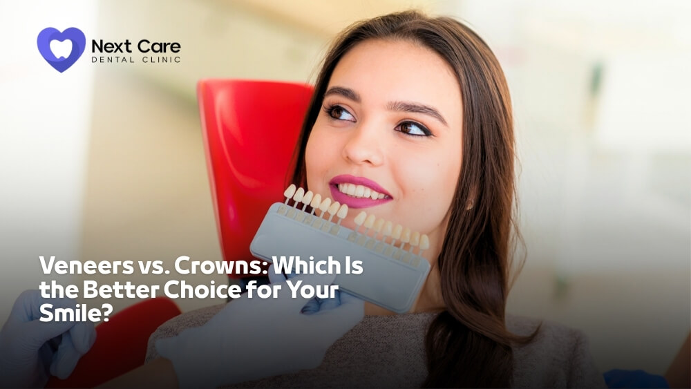 Veneers vs Crowns Which Is the Better Choice for Your Smile - Next Care Dental Clinic