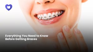 Getting Braces in Deira Dubai | Next Care Dental Clinic
