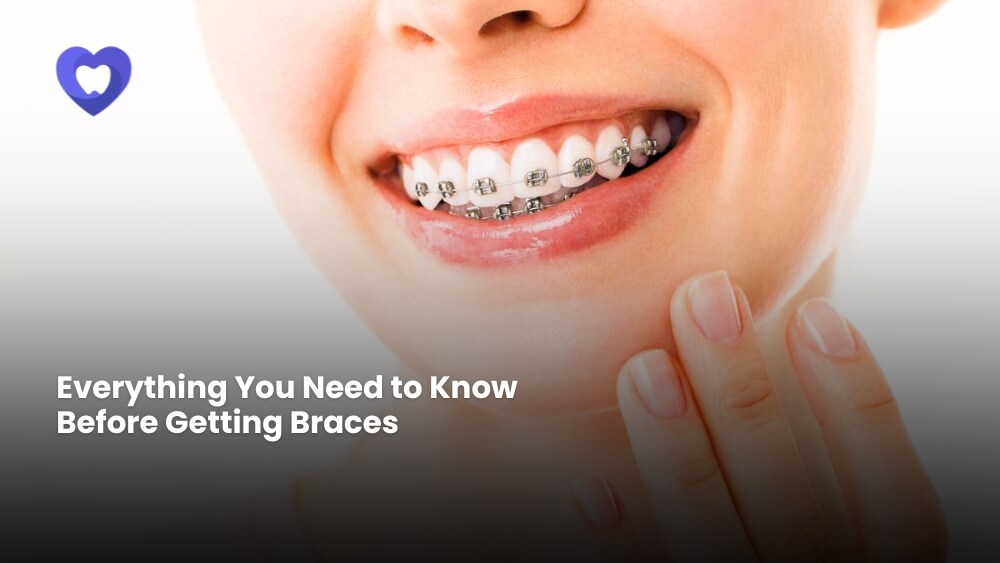 Getting Braces in Deira Dubai | Next Care Dental Clinic