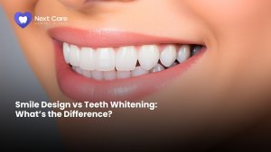 Smile Design vs Teeth Whitening What’s the Difference - Next Care Dental Clinic in Dera, Dubai