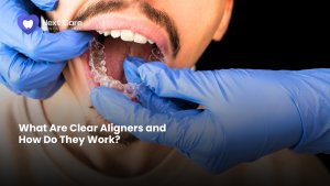 What Are Clear Aligners and How Do They Work - Next Care Dental Clinic in Dera, Dubai